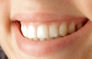 Pravilna oralna higijena sprečava karijes i bolesti desni, ključna je za zdravlje i samopouzdanje.