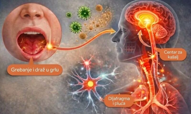 Ilustracija refleksa suhog kašlja sa prikazom nadraženog grla, centra za kašalj u mozgu i reakcije dijafragme i pluća.